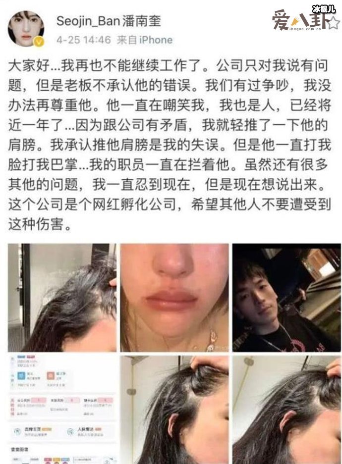 潘南奎为什么叫花蛇, 曝光潘南奎被打的原因